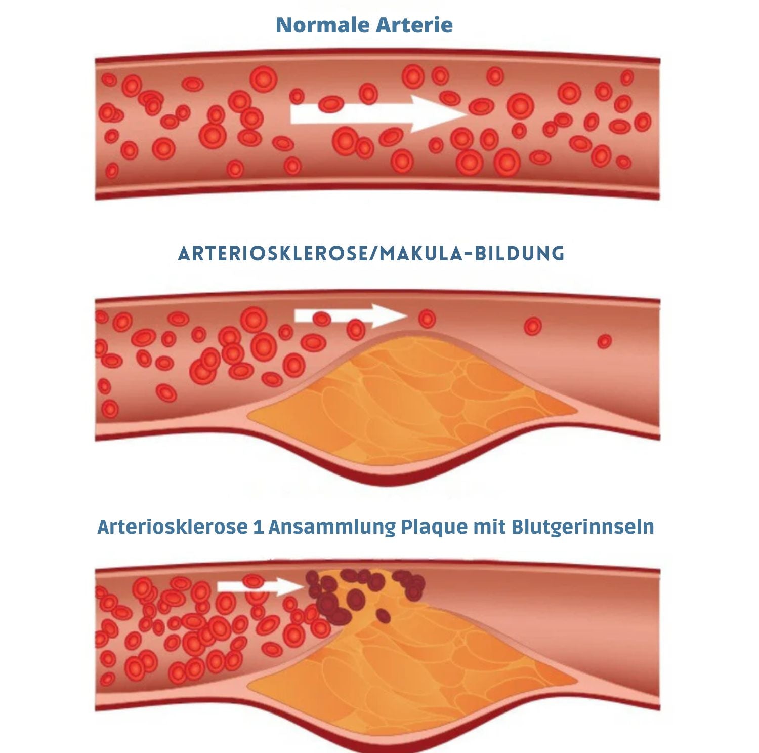 Serenosole™ GluCare Blutzuckermessgerät | Schmerzfreie Gesundheitsüberwachung mit High-Tech-Verstand